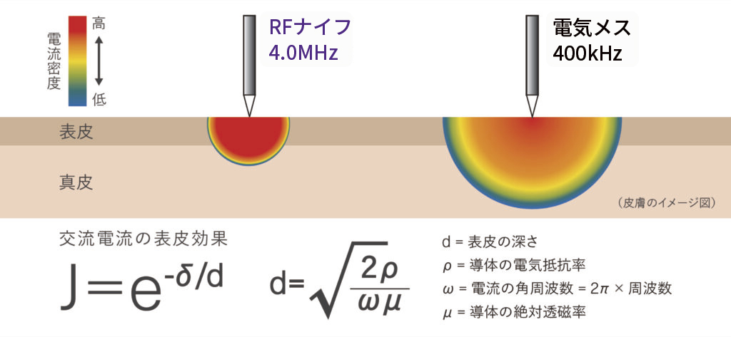 4.0MHz/1.7MHzによる表皮効果で実現する効率的な切開・凝固