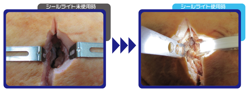 シールライトの特徴