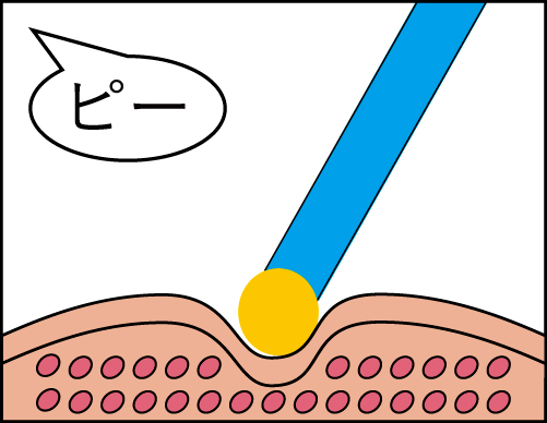 モノポーラ悪い例×